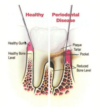 Periodontal Overview